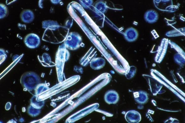 Cara Paling Ampuh Mengatasi Alga Coklat di Akuarium